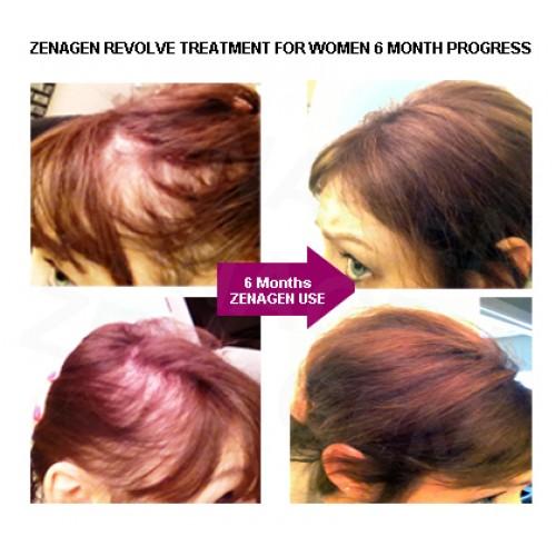 Zenagen Revolve Treatment for Women 6 oz.